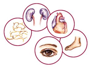 Bodies with the consequences of the mellitus of diabetes